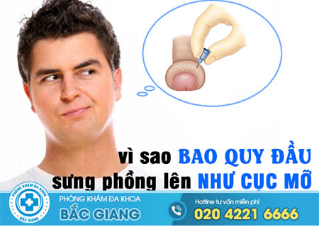 Bao quy đầu bị sưng phồng lên như cục mỡ