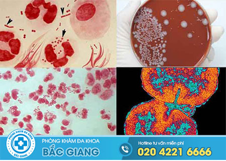 Các bệnh nhiễm trùng qua đường tình dục