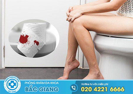 Đại tiện ra máu nhưng không đau