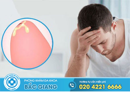 Dương vật chảy mủ trắng đục