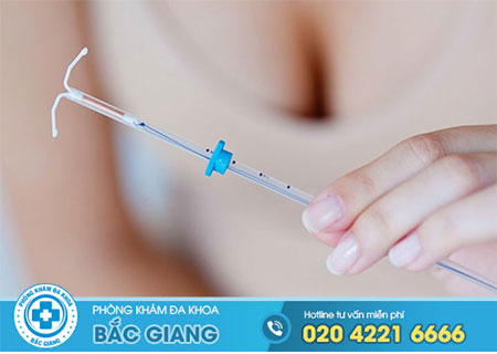 Đặt vòng tránh thai có tốt không?