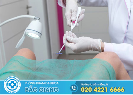 Đặt vòng tránh thai khi nào quan hệ được?