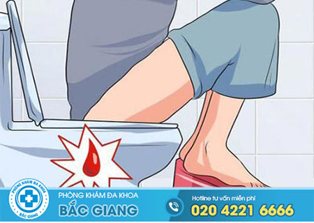 Đi cầu ra máu và rát hậu môn