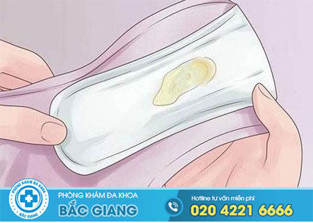 Khí hư màu vàng đặc dính