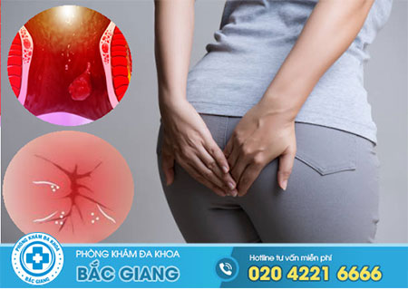 Ngứa và chảy máu hậu môn