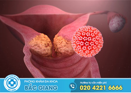 Sùi mào gà cổ tử cung có nguy hiểm không