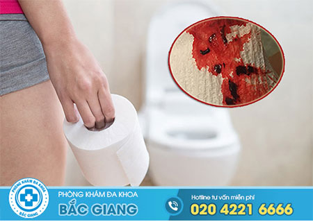 Táo bón chảy máu hậu môn