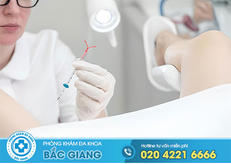 Đặt vòng tránh thai có hại không?