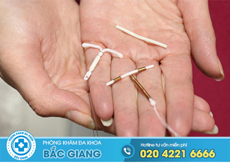 Đặt vòng tránh thai khi nào?